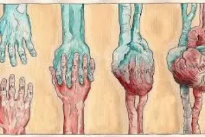 Yeniden sevmek mümkün mü?