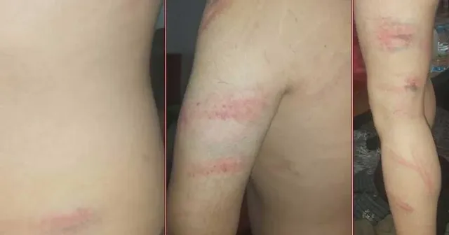 Üniversite tuvaletinde işkence ve darp iddiası