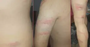 Üniversite tuvaletinde işkence ve darp iddiası