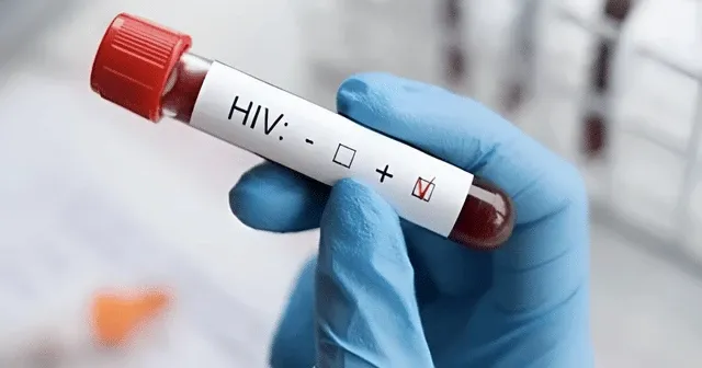 HIV+ olduğunu eşinden saklayan kişiye "kasten öldürmeye teşebbüs" suçundan dava